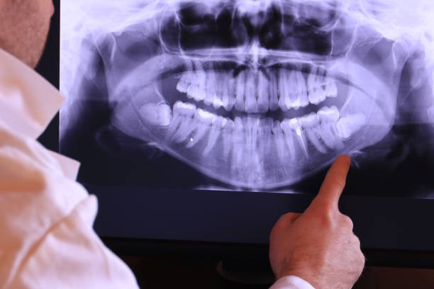 Best Emergency Tooth Extraction in Mount Vernon, WA