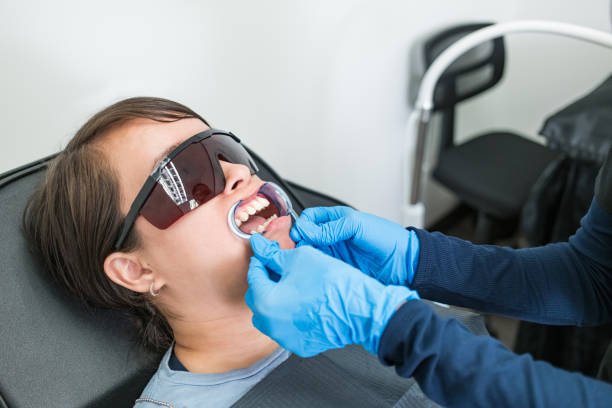 Best Emergency Wisdom Teeth Removal in Mount Vernon, WA